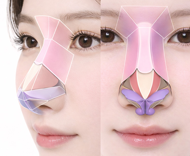 3d diamond Tip Rhinoplasty