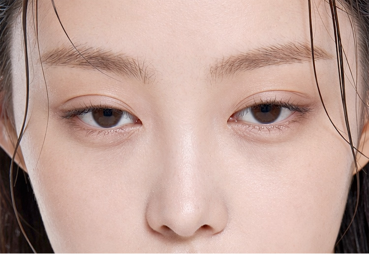 ptosis surgery point