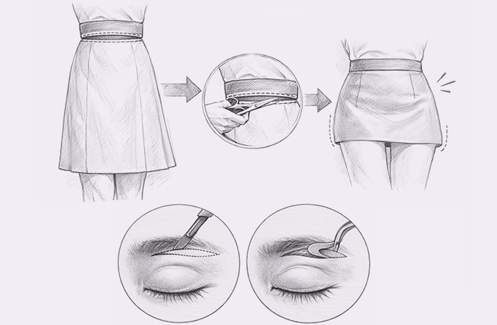 ptosis surgery step2 