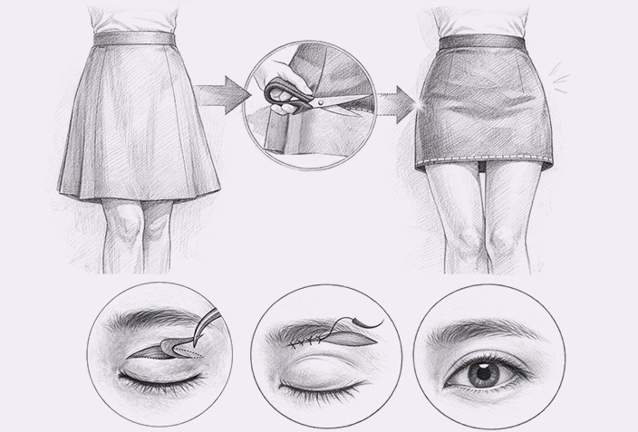 ptosis surgery step3 